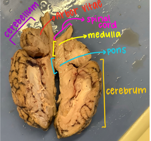 科學課上的腦解剖標記